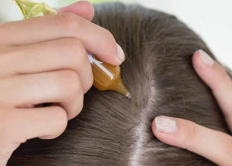 Cómo combatir la caída del cabello naturalmente | Blog | Vidaliax