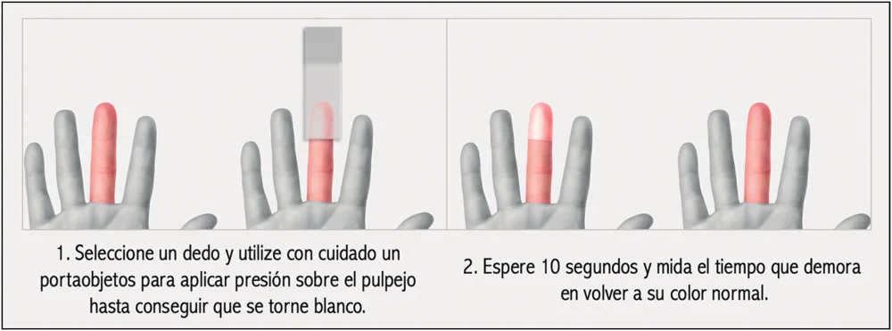 ¿Qué es el tiempo de llenado capilar? | Guía de salud | Vidaliax