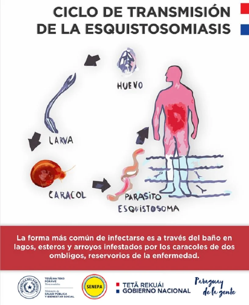 ¿Qué es la esquistosomiasis? | Guía de salud | Vidaliax