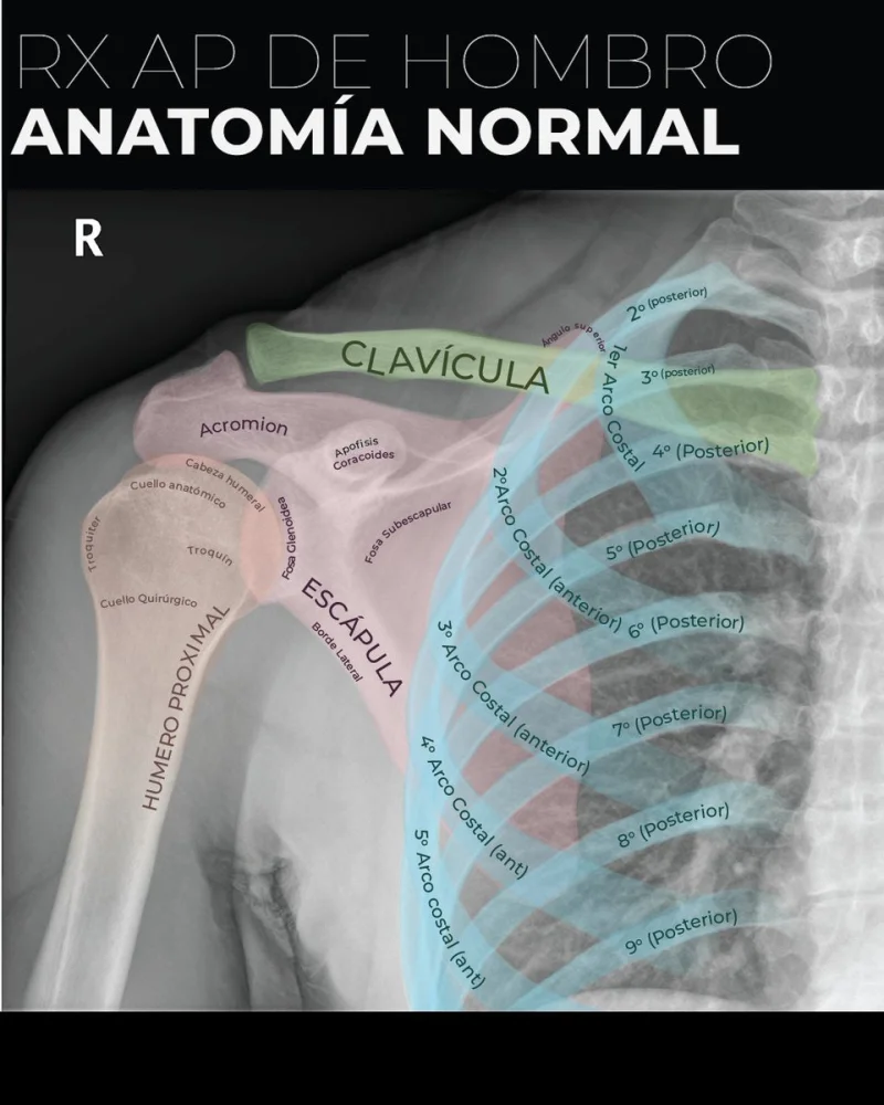 Radiografía de hombro: anatomía, procedimiento y qué esperar | Guía de ...